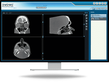 XoranConnect-image-Screen