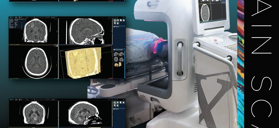 xCAT IQ Brain Scans