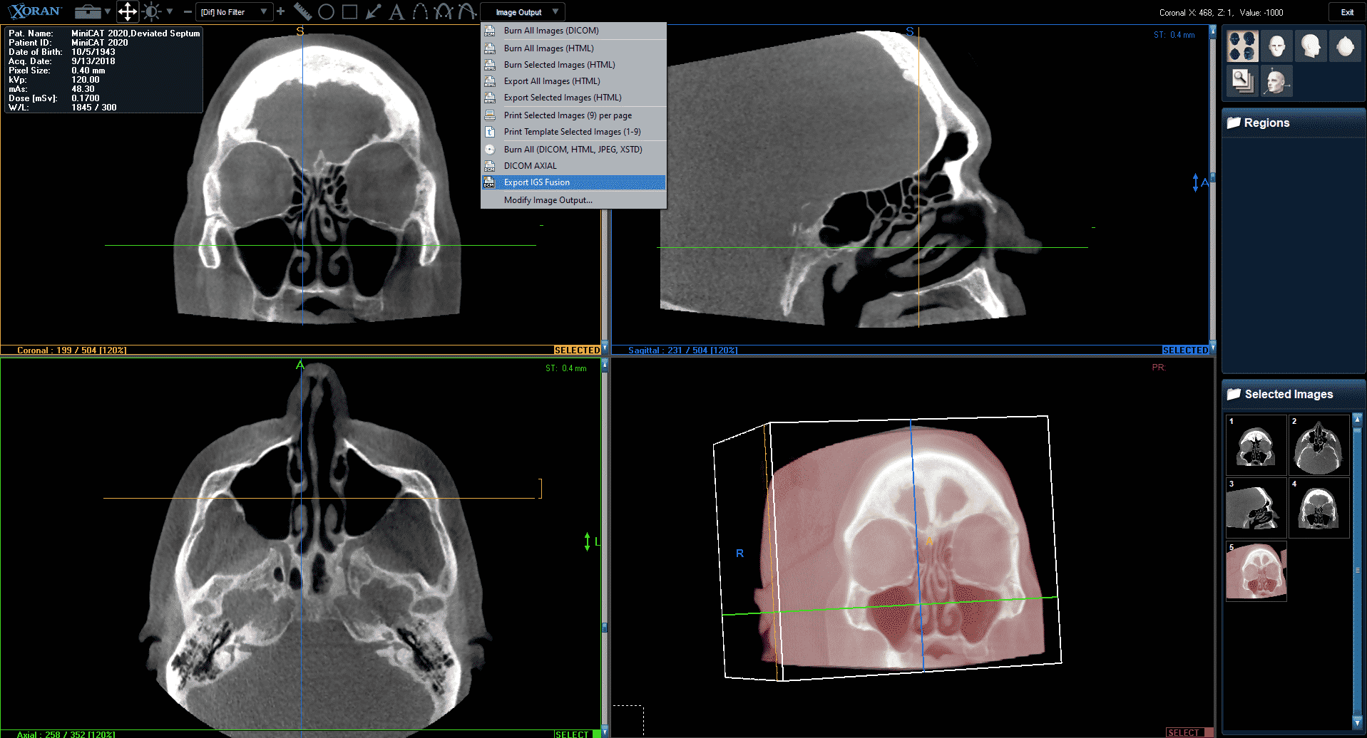 MiniCAT 2020 Sample Scan